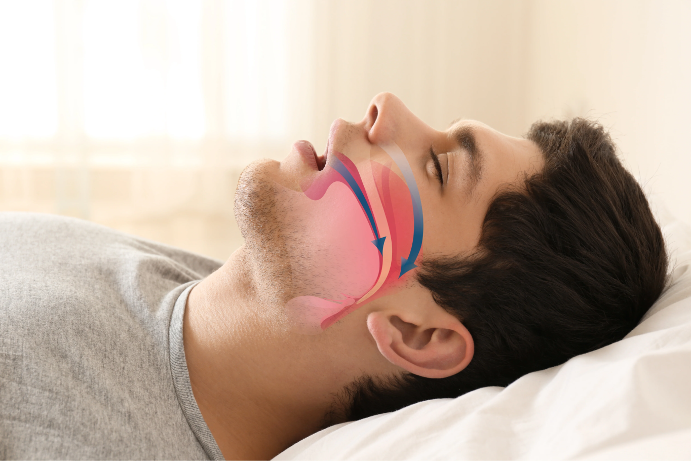 Snoring / Obstructive Sleep Apnoea Management